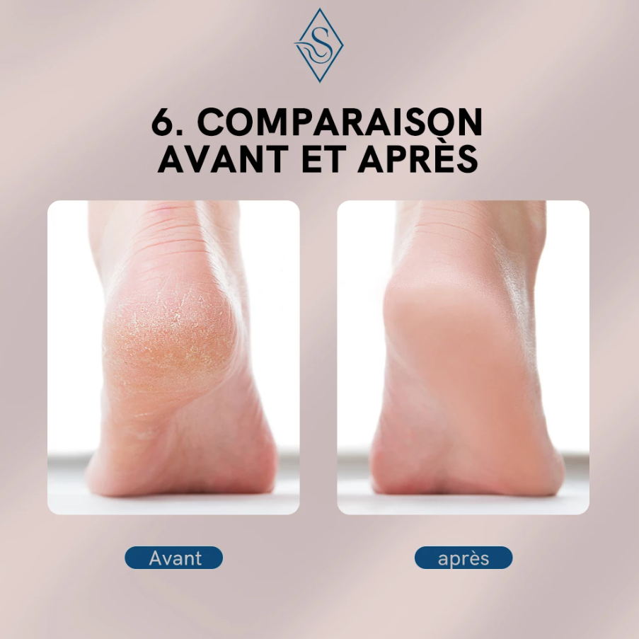 Lime électrique anti-callosité pour pied