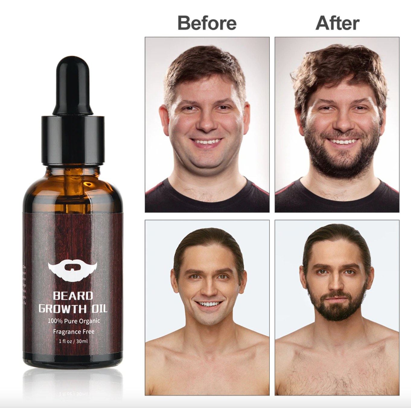 Kit complet de croissance pour barbe