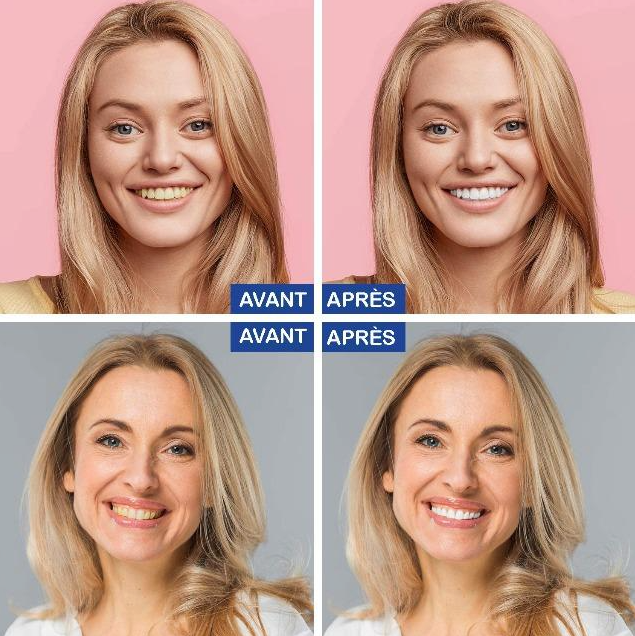 14x Bandes blanchiment dentaire