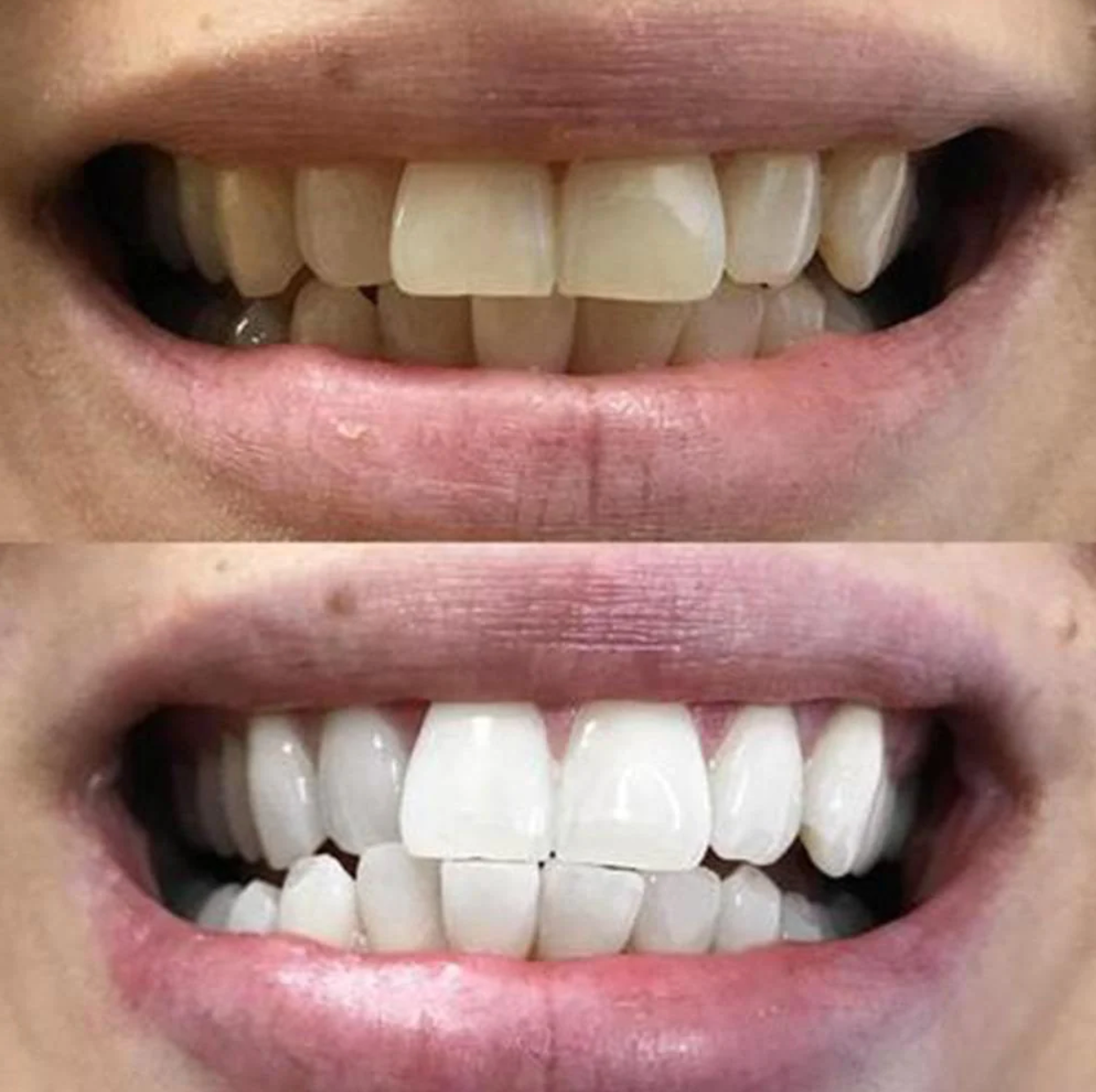 Stylo magique dents blanches