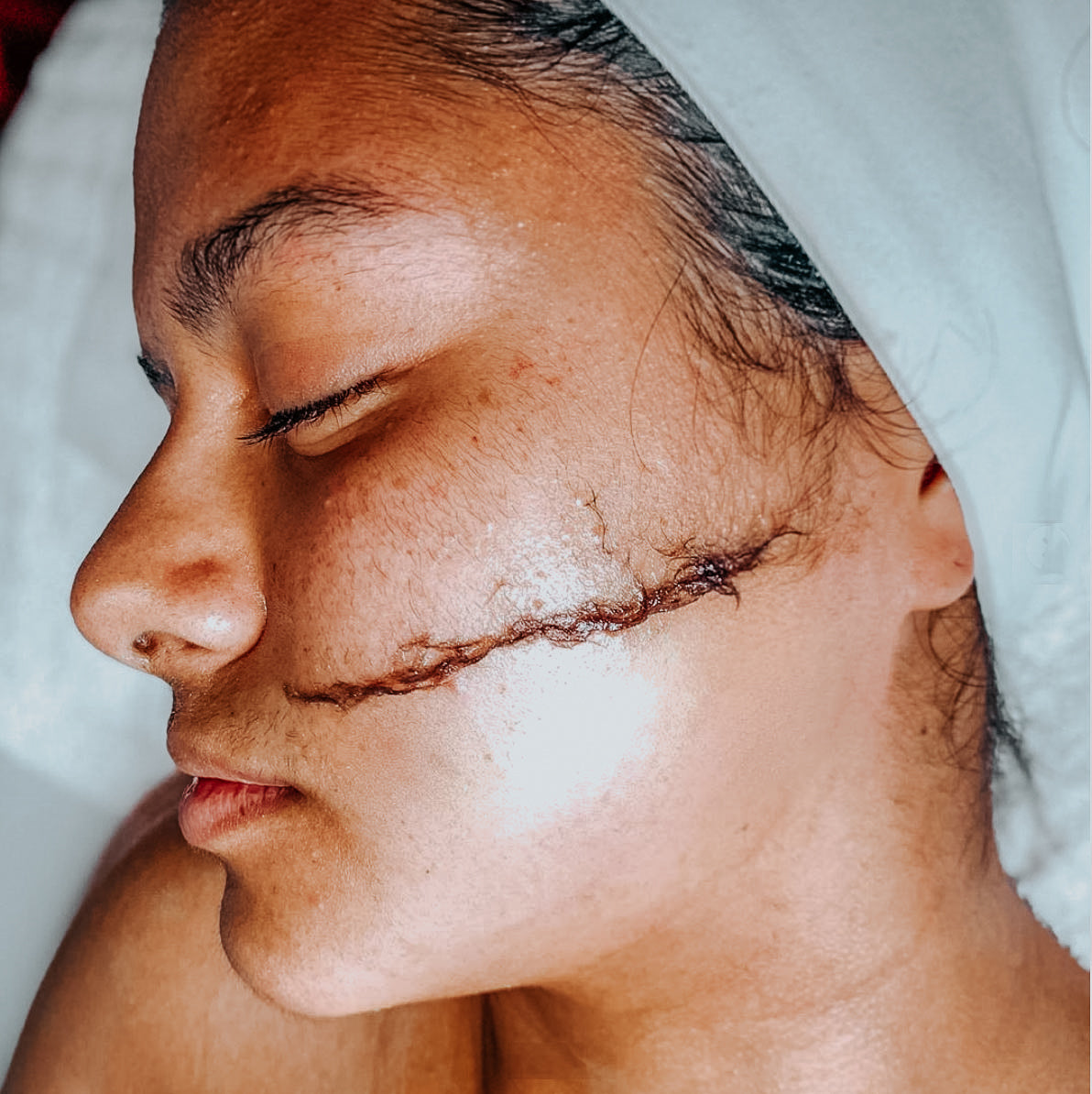 Lot de 10 rasoirs scalpels de Dermaplaning visage - Exfoliant & Rasage