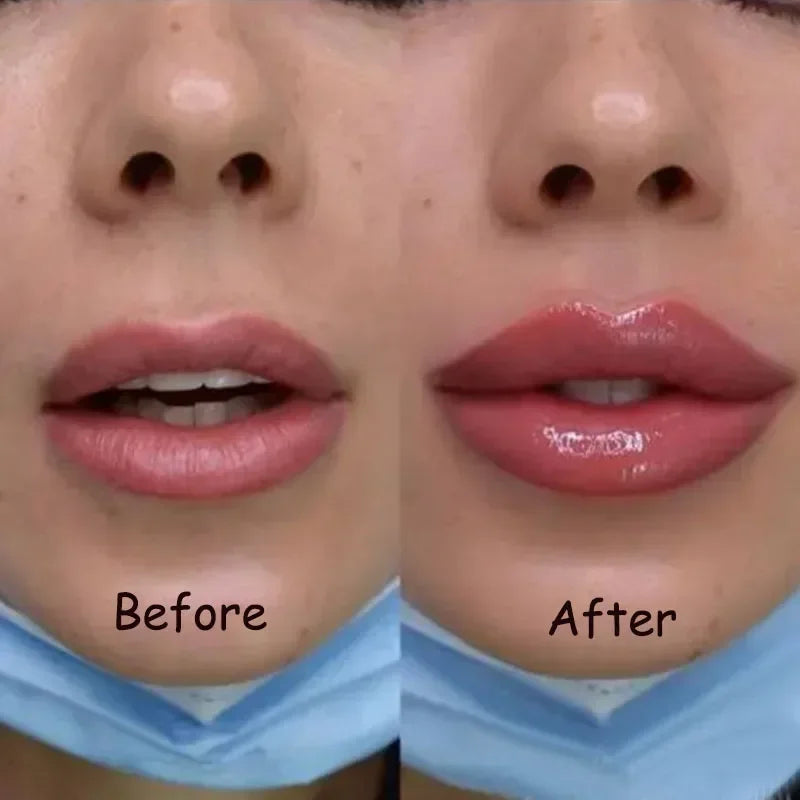 Aceite voluminizador instantáneo para labios