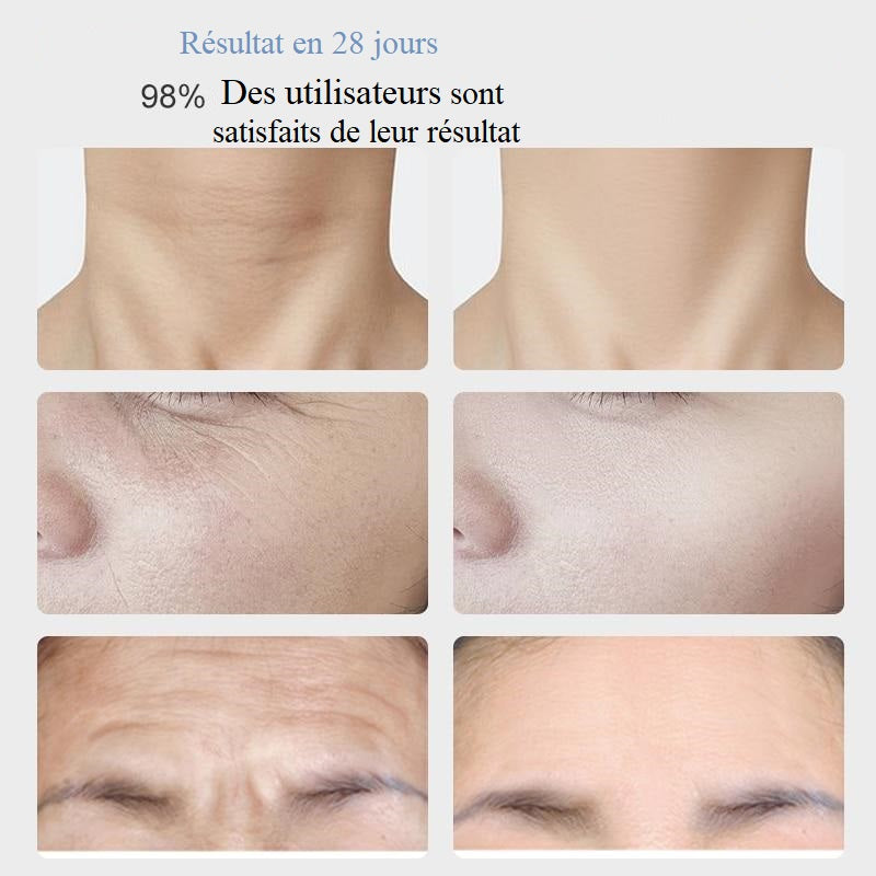 Masseur lifting cou et visage EMS