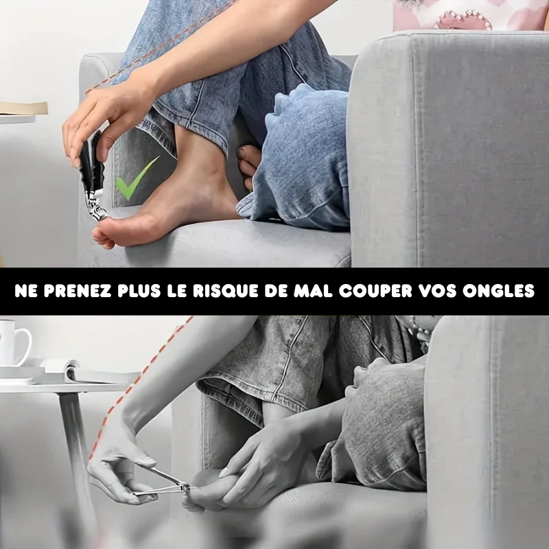 Ensemble de Coupe-ongles pour Ongles Incarnés - 4PCS